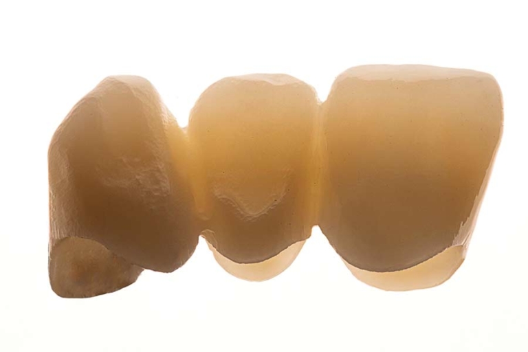 seramicCAM® Zirkon MultiSHT - seramiccam